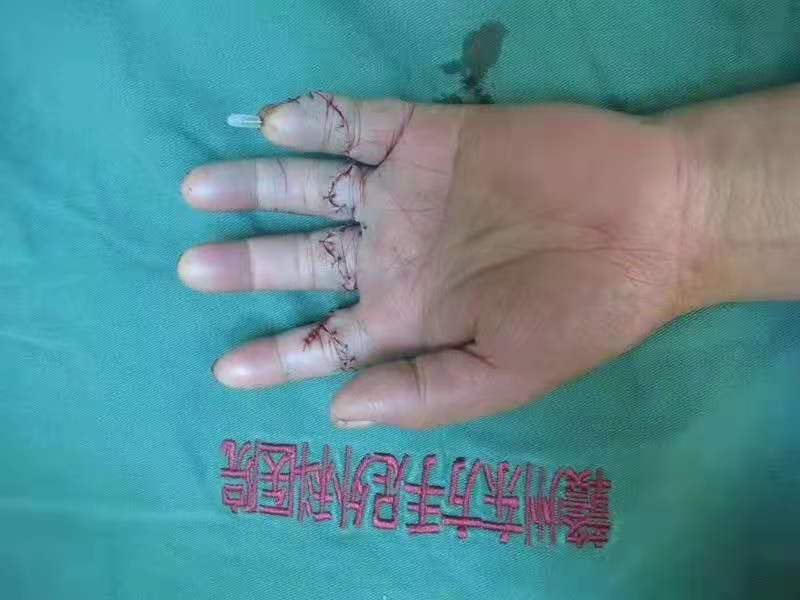 专业保肢减残