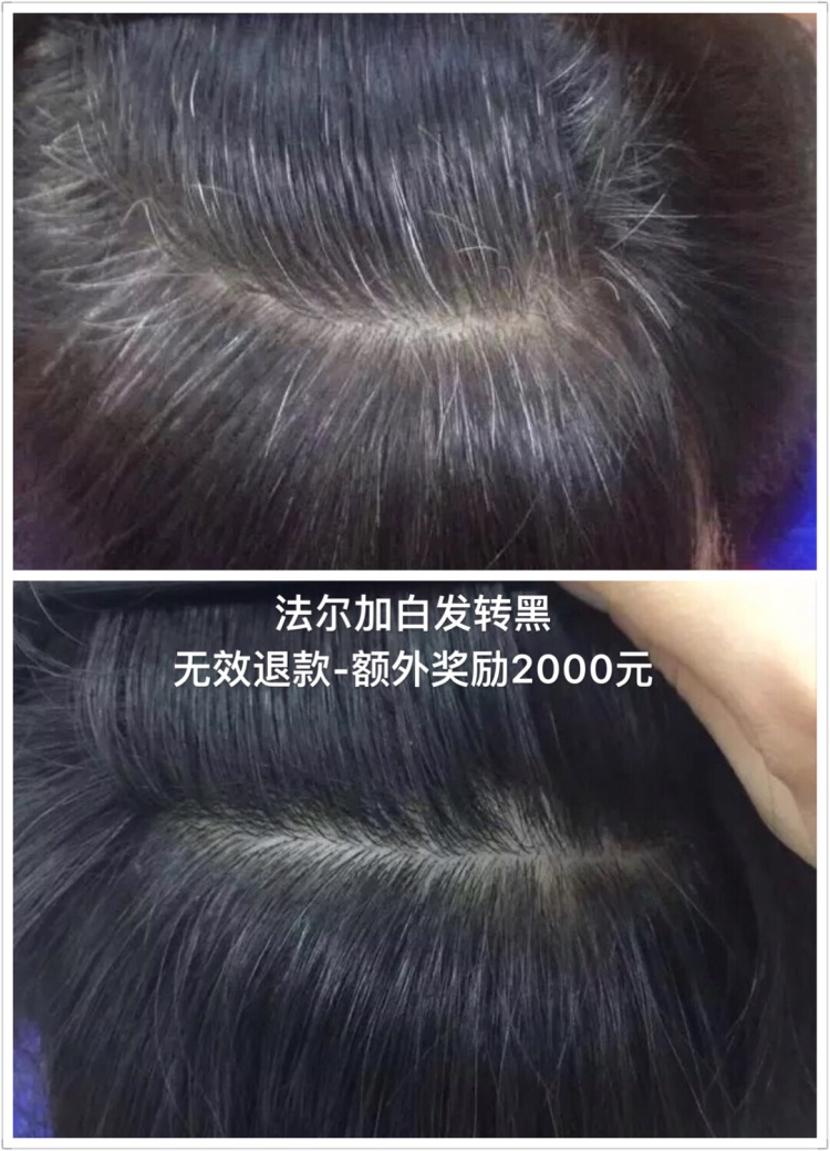 效果见证-法尔加白发转黑对比效果-对比效果-英国