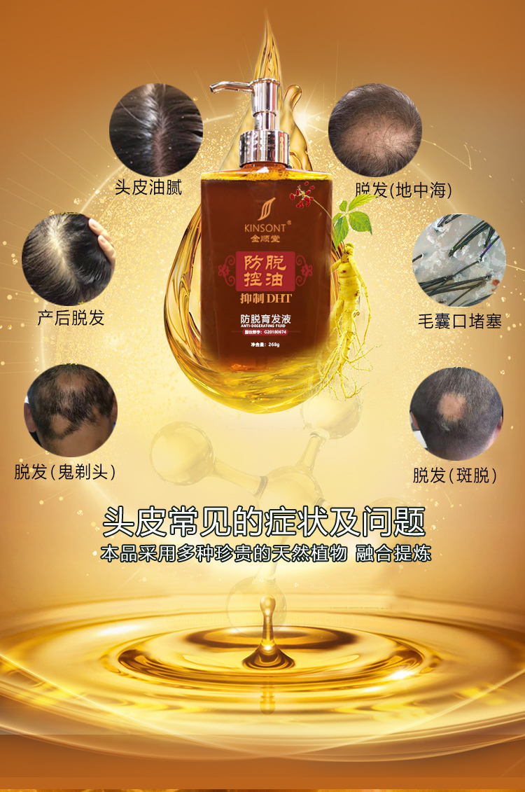 防脱育发液