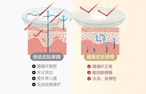 皮肤屏障2.png