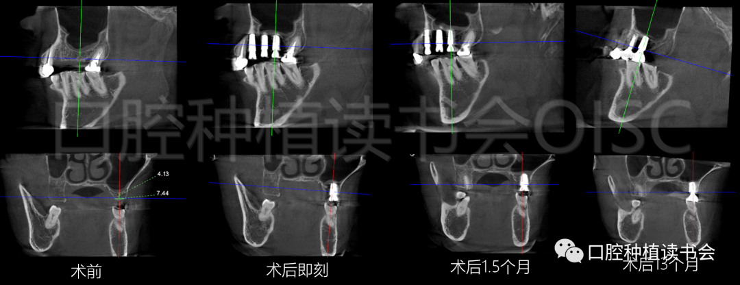20210126095159_74018.png 图33.png