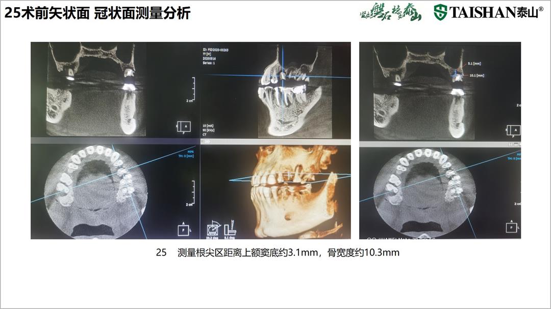 幻灯片5.jpg