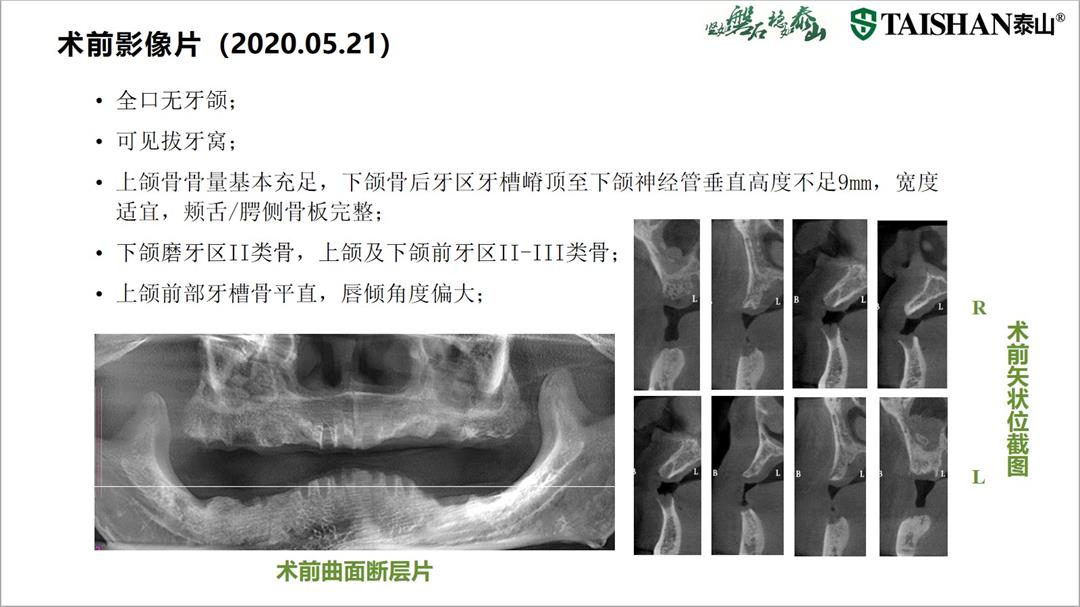 幻灯片4.jpg