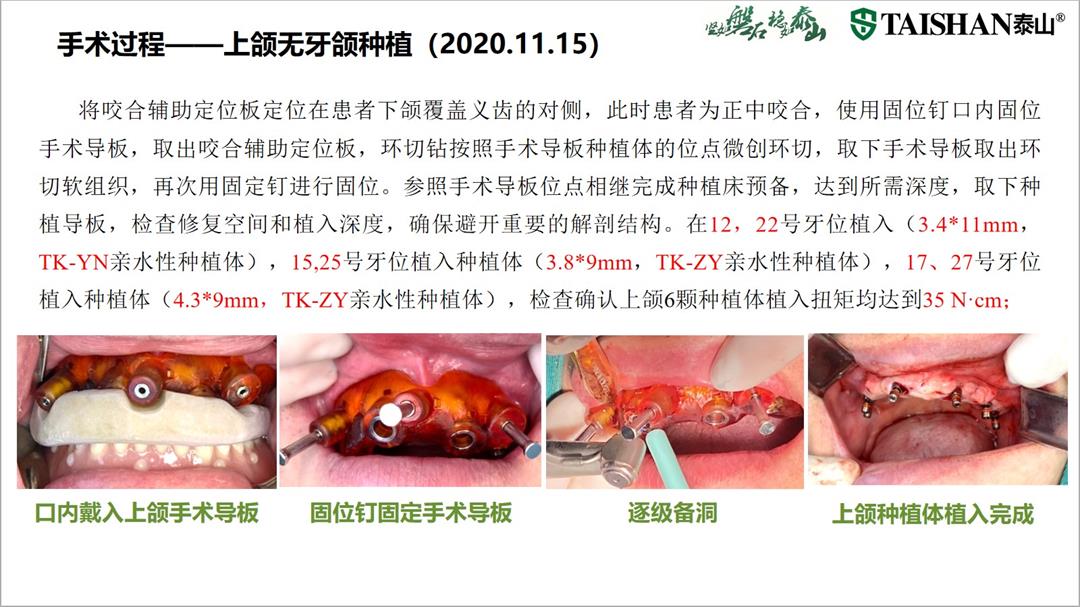 幻灯片13.jpg