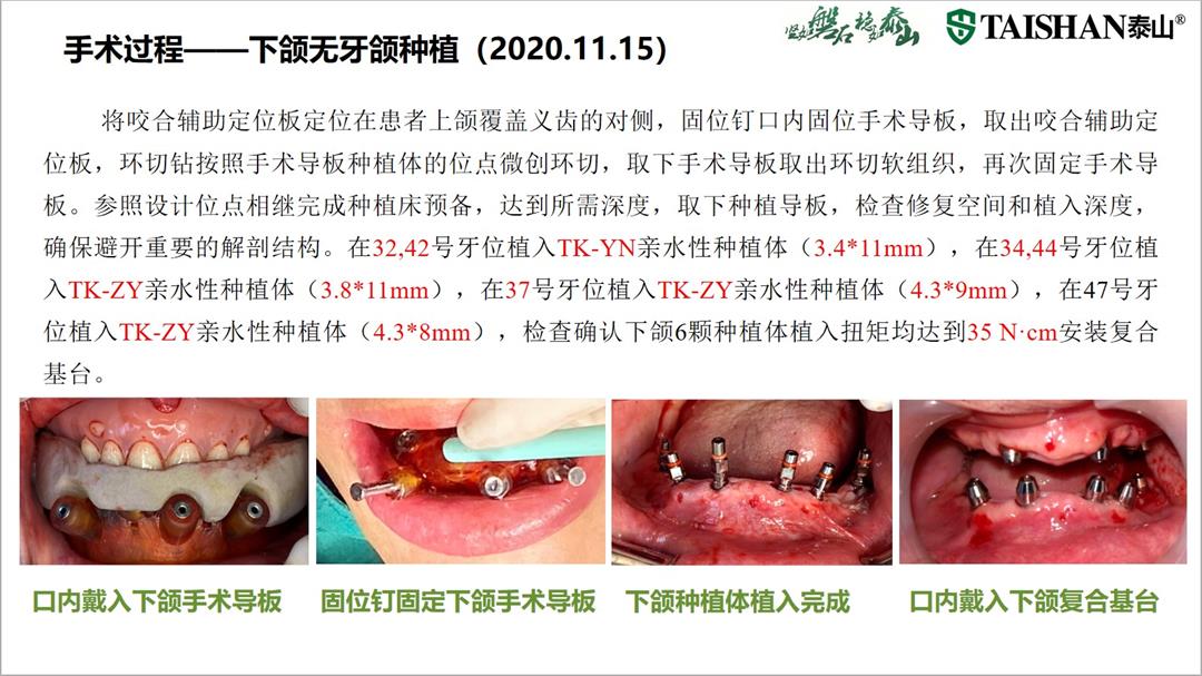 幻灯片14.jpg