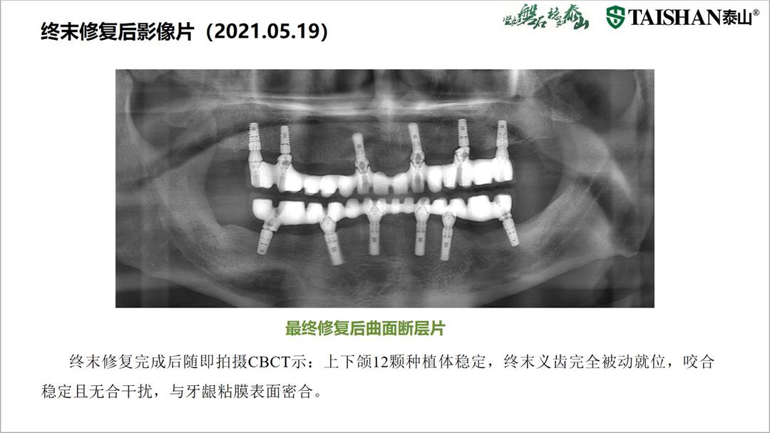 幻灯片23.jpg