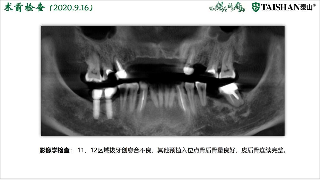 幻灯片5.jpg