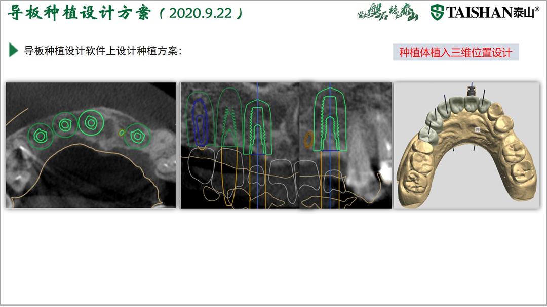 幻灯片7.jpg