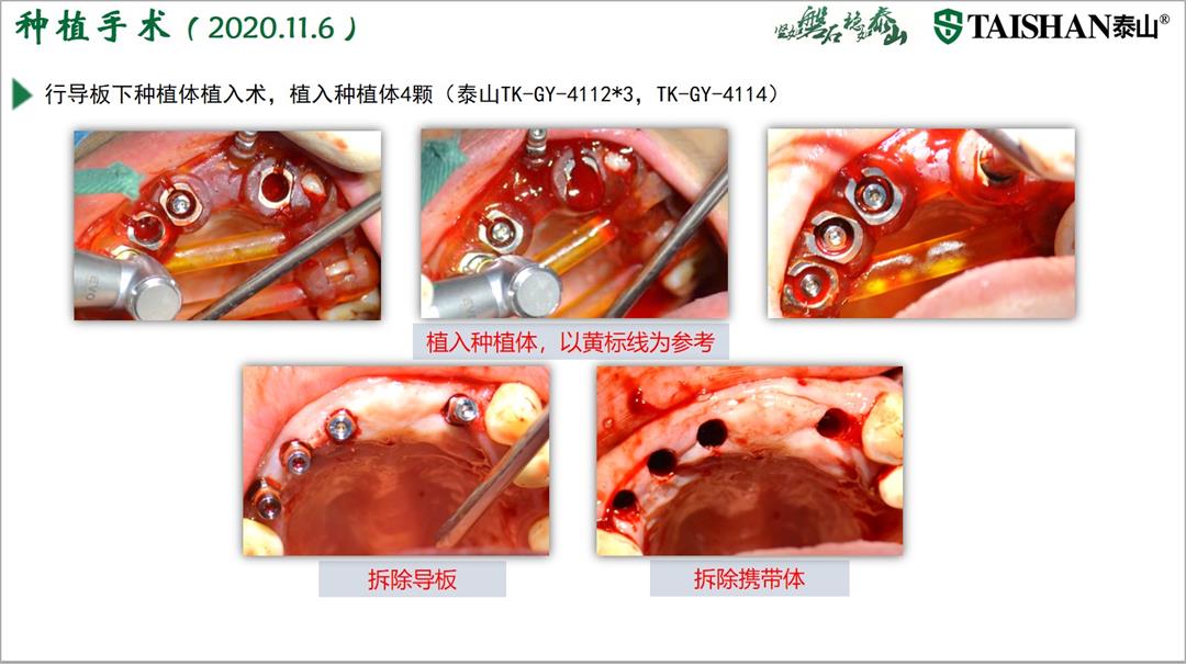 幻灯片14.jpg