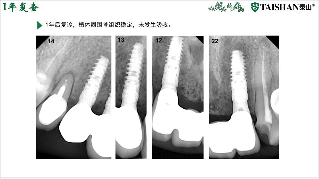 幻灯片25.jpg