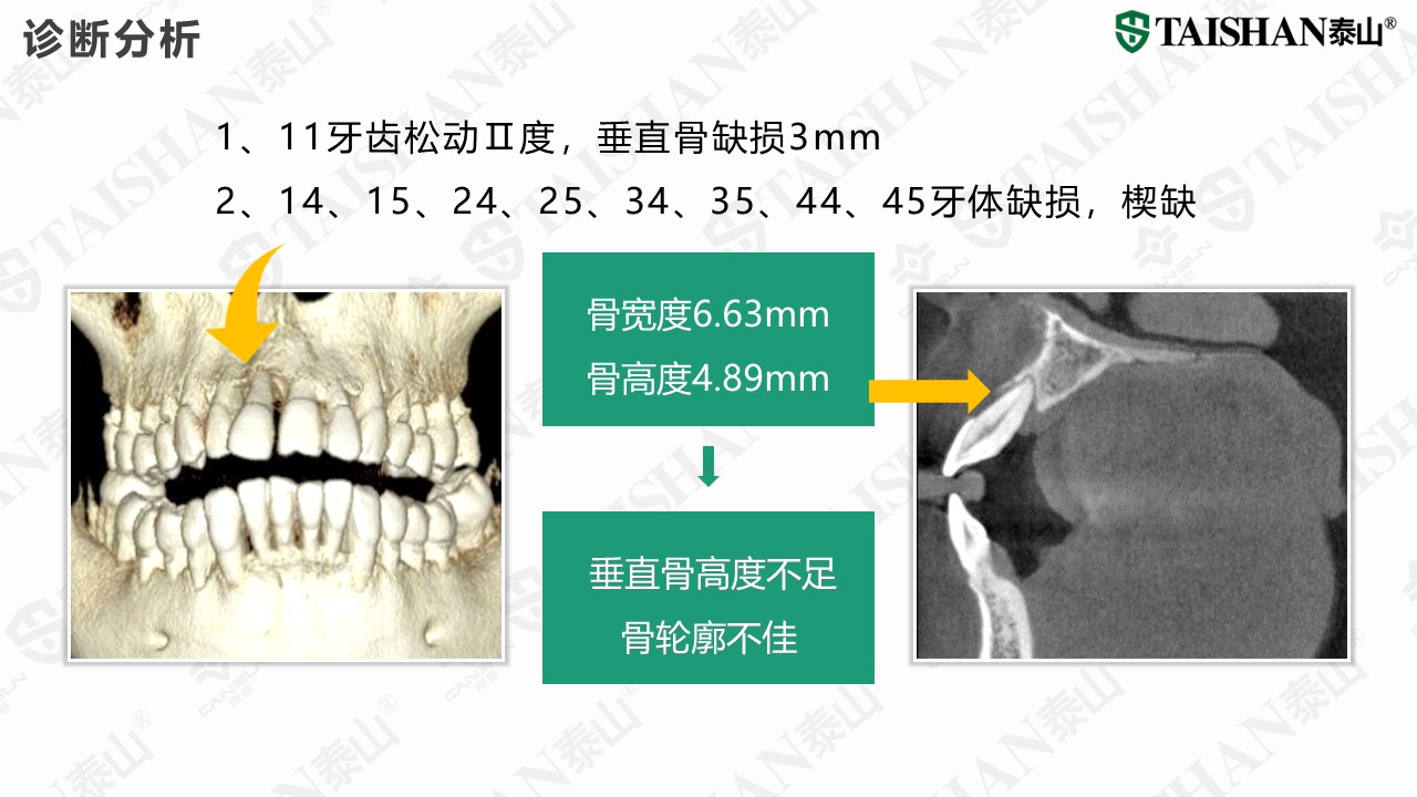幻灯片5.JPG
