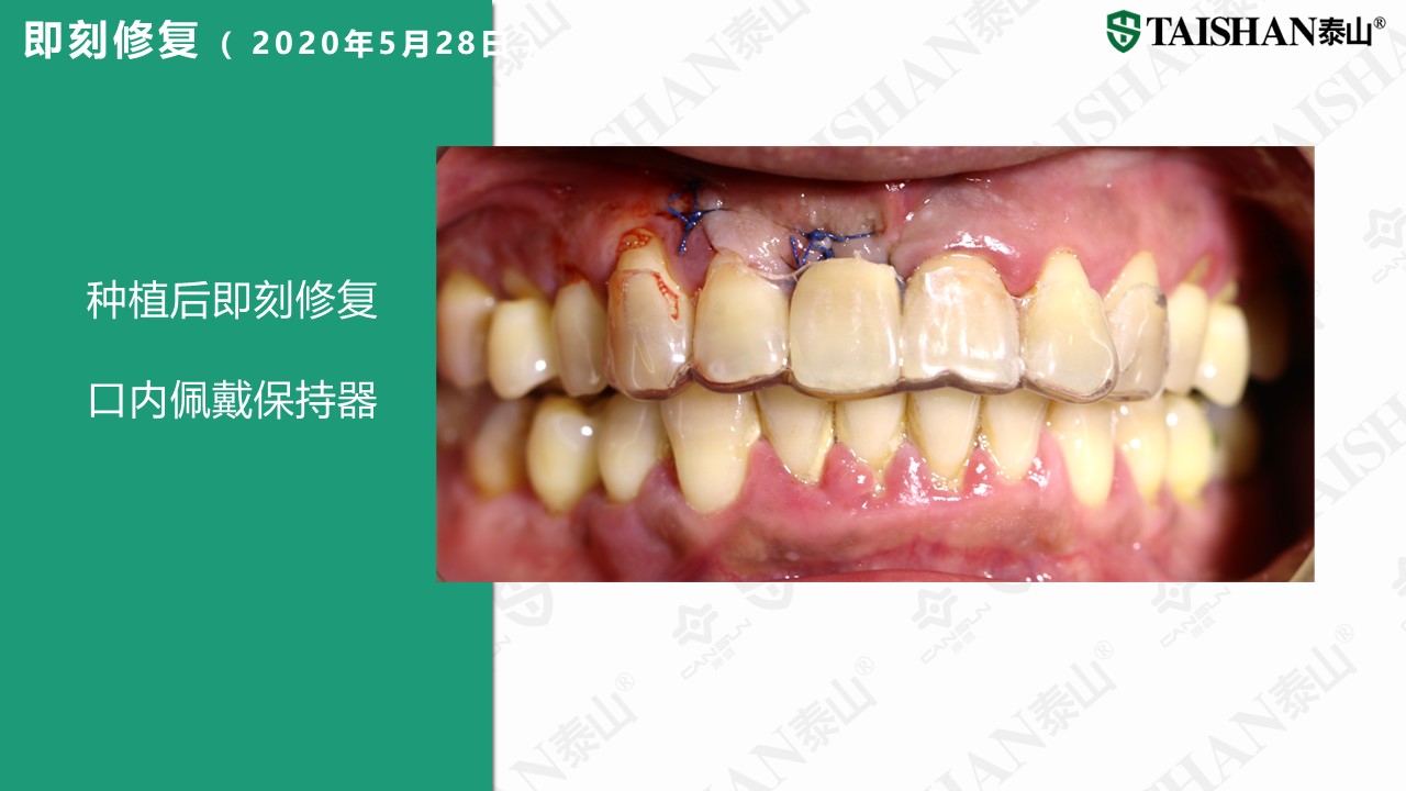 幻灯片11.JPG