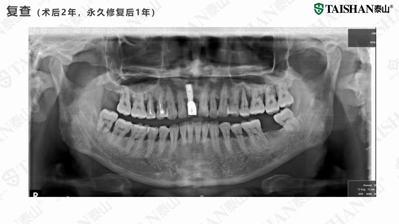 幻灯片15.JPG
