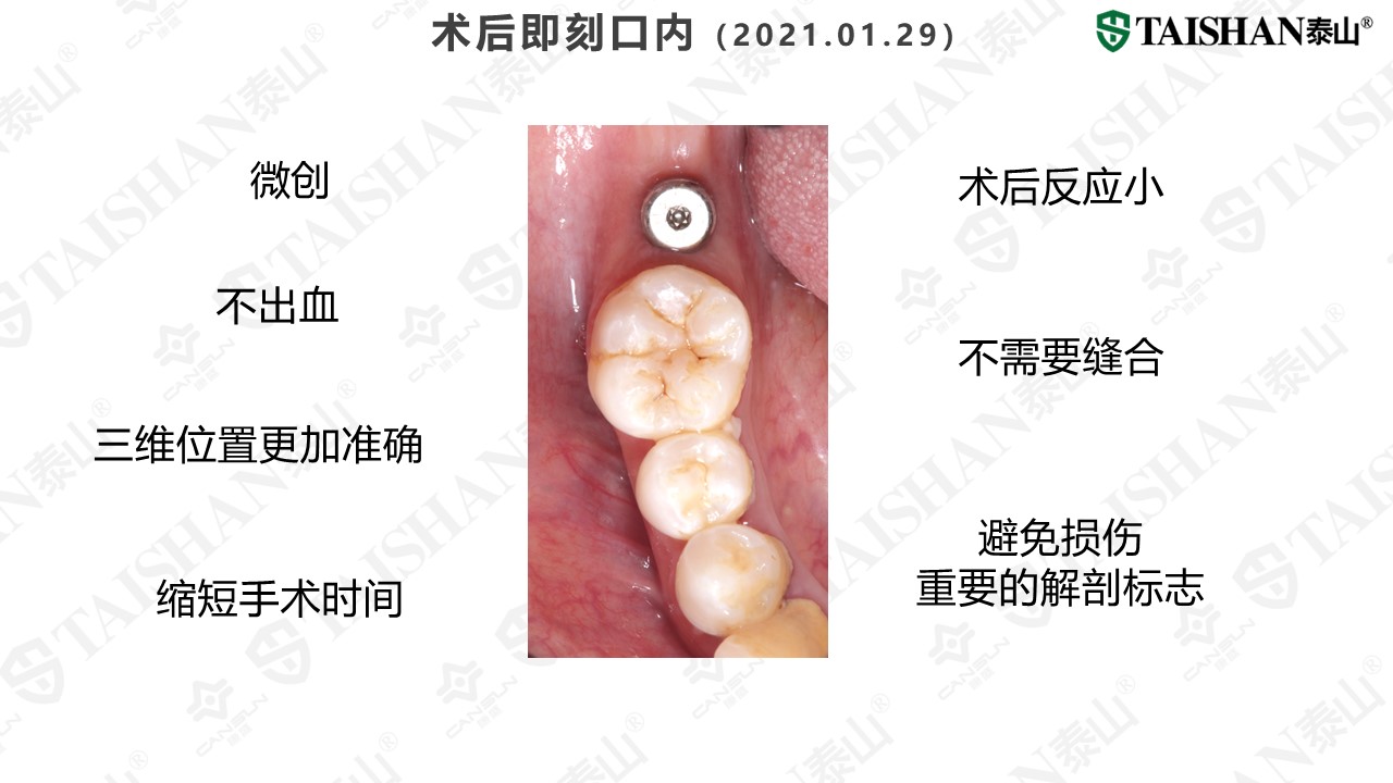 幻灯片14.JPG