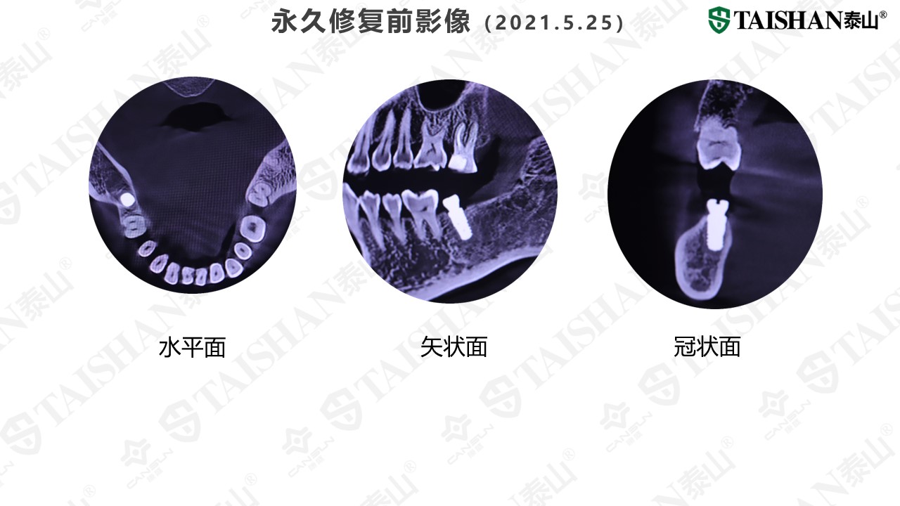 幻灯片19.JPG