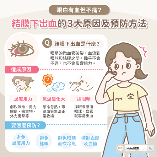 眼白有血但不痛？結(jié)膜下出血的３大原因及預(yù)防方法