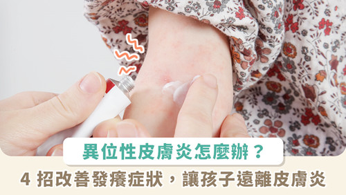 流汗、不流汗都難受！ 爸媽快學(xué)4招改善異位性皮膚炎孩子癥狀