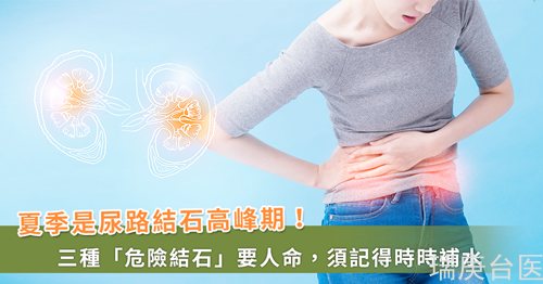 夏天尿路結(jié)石患者增！醫(yī)解析「安靜結(jié)石VS危險(xiǎn)結(jié)石」當(dāng)心要人命