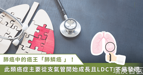 肺鱗癌是肺癌中的癌王！醫(yī)師：難早期發(fā)現(xiàn)、藥物選擇少、治療預(yù)后差