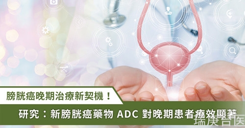 治療新契機(jī)！膀胱癌 ADC 藥物 為晚期患者帶來一線生機(jī)