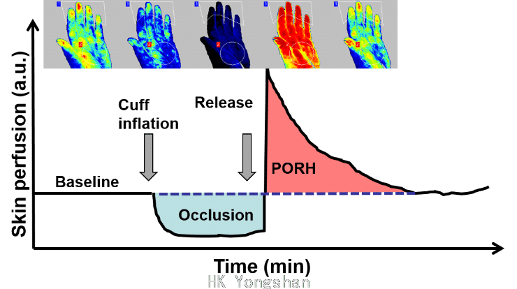 20210924094619_39561.png Post-Occlusive-Reactive-Hyperemia.png