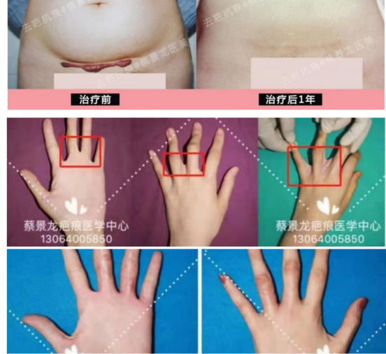 图片39(1).png